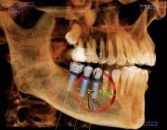 3D imaging displays more detail