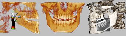 CT scanning produces detailed images